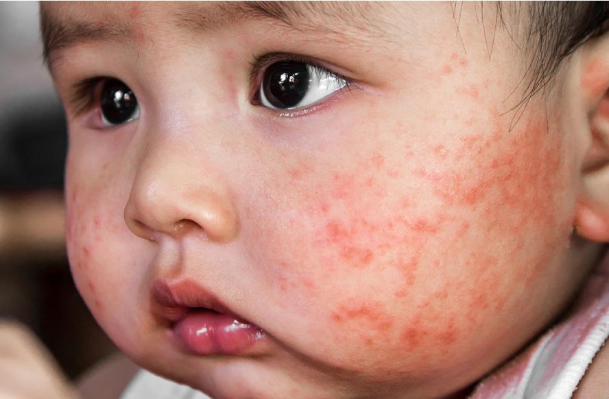 Dermatología
